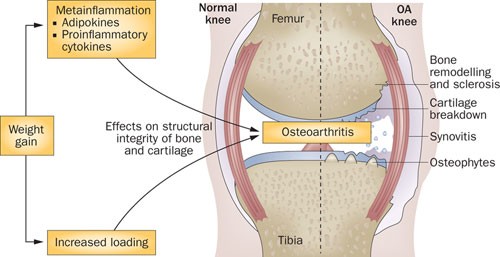 Source: https://www.nature.com/articles/nrrheum.2012.224 