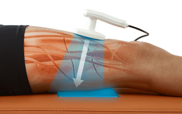 Tecar Therapy Capacitive