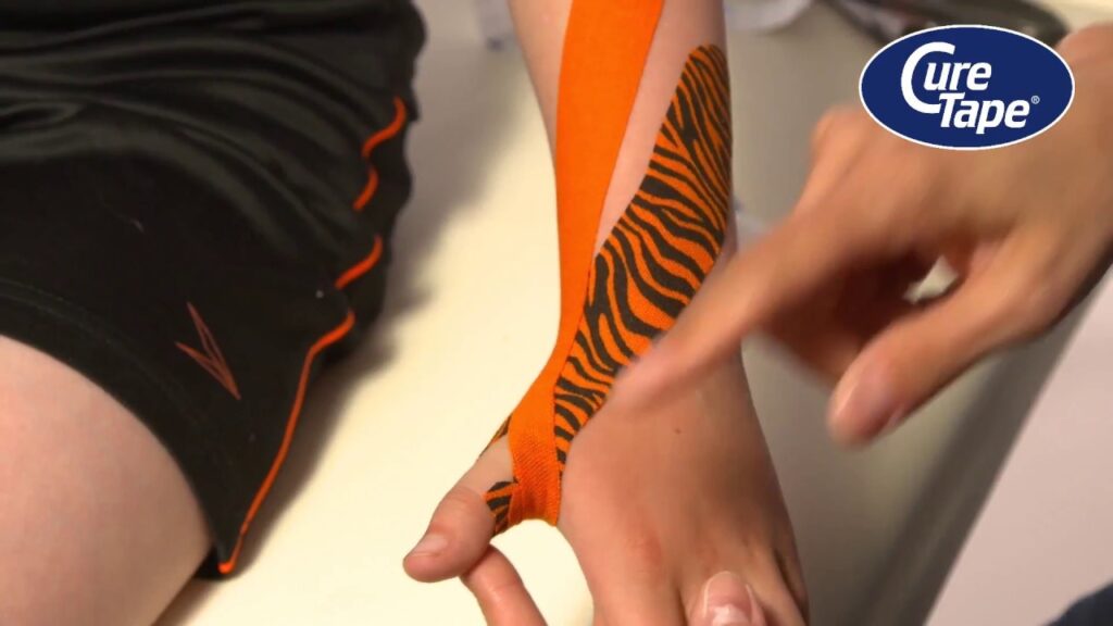 https://www.curetape.com/kinesiology-taping-instructions/arm-hand/thumb-tendonitis-or-de-quervains-tenosynovitis/